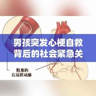 男孩突发心梗自救背后的社会紧急关注